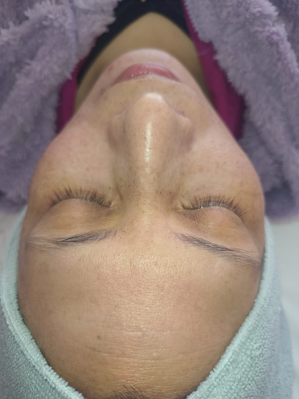 Detalle de tratamiento facial