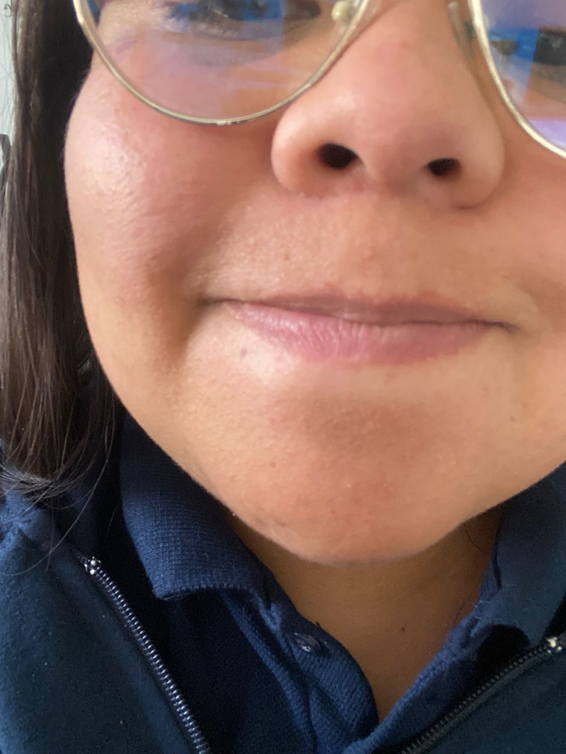 Imagen facial de tratamiento 4